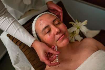 Acupuntura facial,gua sha,masaje facial,rejuvenecimiento facial,bienestar facial,Centro Chí Ourense